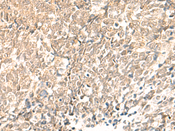 兔抗TBPL1多克隆抗体