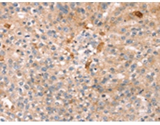 兔抗THAP9多克隆抗体