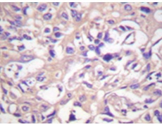 兔抗TK1(Ab-13) 多克隆抗体