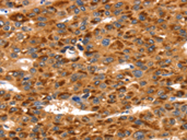 兔抗TLN1多克隆抗体