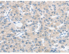 兔抗TM9SF1多克隆抗体