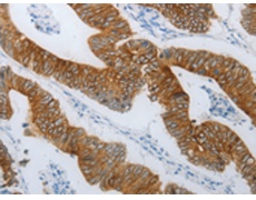 兔抗TMEM8B多克隆抗体