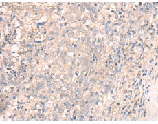 兔抗TMEM45A多克隆抗体