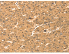 兔抗TMEM123多克隆抗体