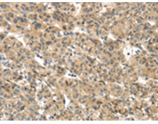兔抗TMEM161A多克隆抗体