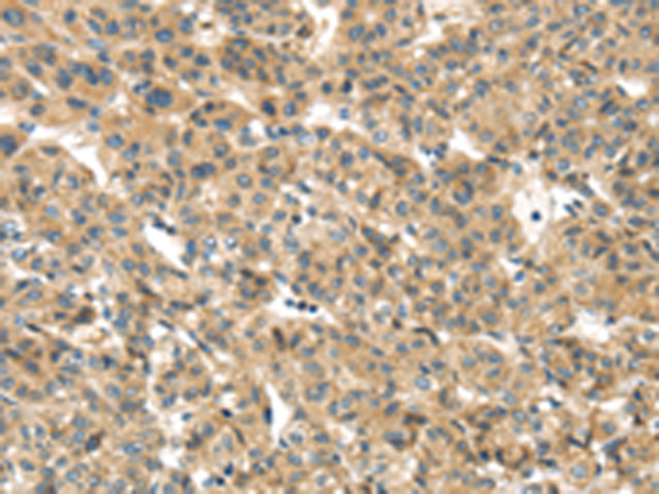 兔抗TMEM161A多克隆抗体