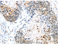 兔抗TMPRSS4多克隆抗体