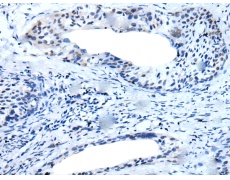 兔抗TMPRSS6多克隆抗体