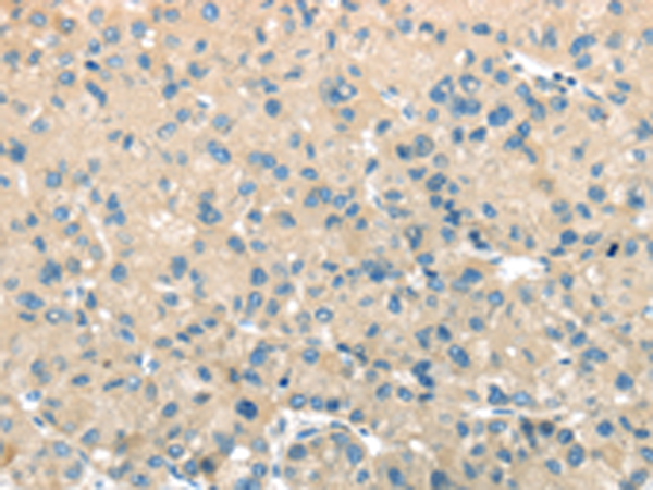 兔抗TMPRSS11A多克隆抗体