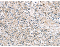 兔抗TMPRSS11B多克隆抗体