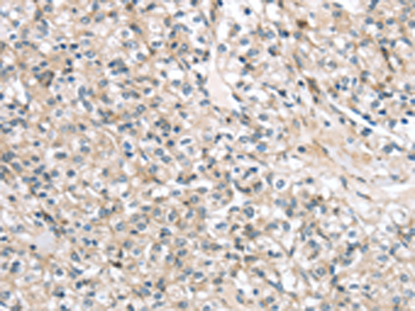 兔抗TMPRSS11B多克隆抗体
