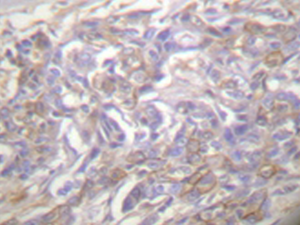 兔抗TNFRSF1A多克隆抗体