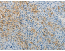 兔抗TNFRSF1B多克隆抗体