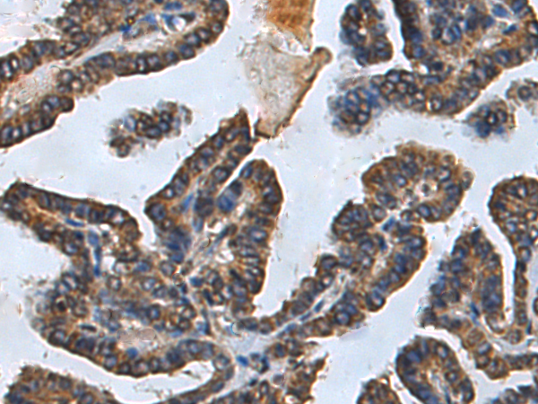 兔抗TNFRSF9多克隆抗体