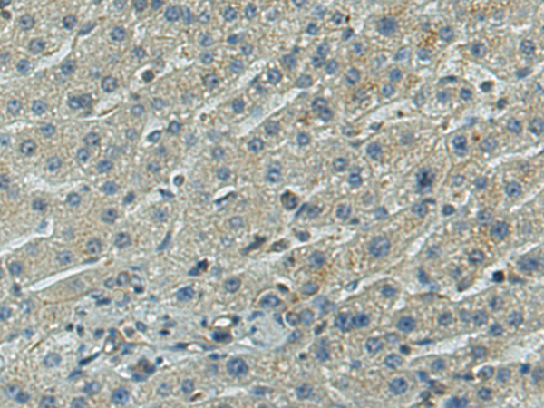 兔抗TNFRSF10A多克隆抗体