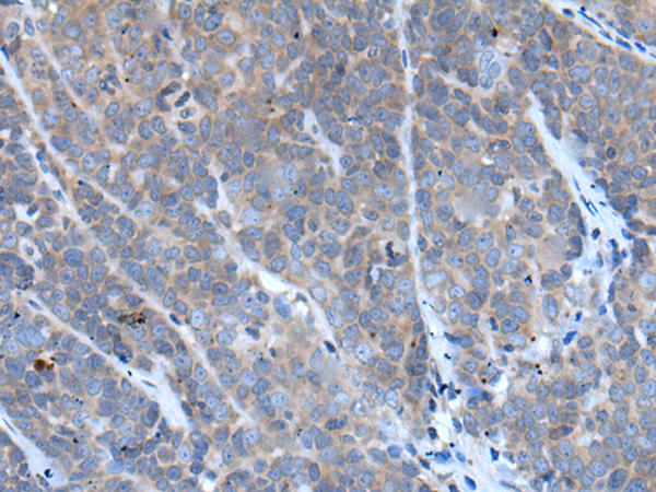 兔抗TNFRSF10C多克隆抗体