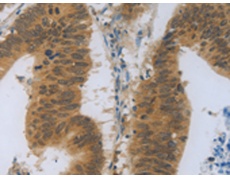 兔抗TNFRSF11B多克隆抗体