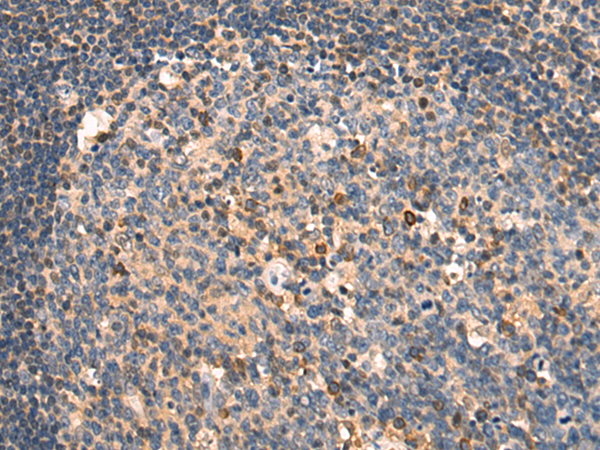 兔抗TNFRSF12A多克隆抗体