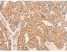 兔抗TNFSF10多克隆抗体