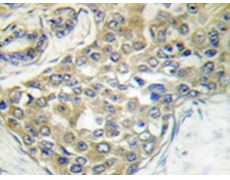 兔抗TNK2(Phospho-Tyr284) 多克隆抗体