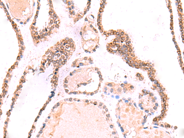 兔抗TOR1AIP1多克隆抗体