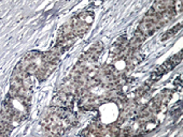兔抗TP53 (Phospho-Ser6)多克隆抗体