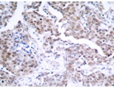 兔抗TP53 (Phospho-Ser15)多克隆抗体