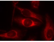 兔抗TP53 (Phospho-Ser46)多克隆抗体