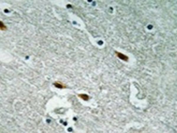 兔抗TP53BP1多克隆抗体