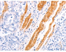 兔抗TPM1多克隆抗体
