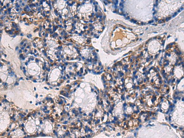 兔抗ABHD14B多克隆抗体