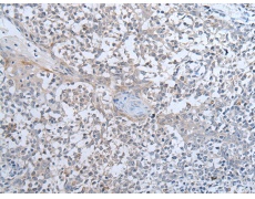 兔抗ABHD6多克隆抗体