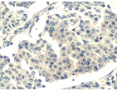 兔抗ABL1ABL2(phospho-Tyr393439)多克隆抗体