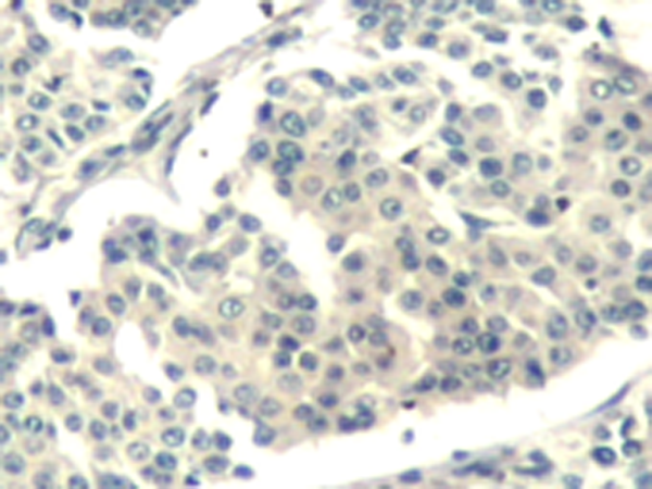 兔抗ABL1ABL2(phospho-Tyr393439)多克隆抗体