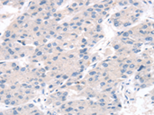 兔抗CHRNA3多克隆抗体