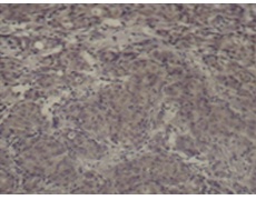 兔抗CREB1(Phospho-Ser142) 多克隆抗体