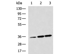 兔抗CASP1多克隆抗体