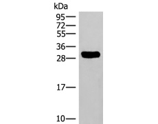 兔抗HLA-DRB3多克隆抗体