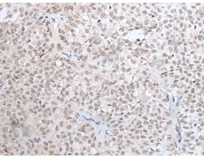 兔抗HOXC11多克隆抗体