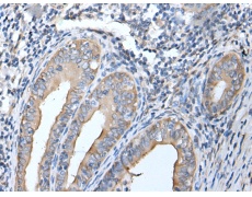 兔抗HSPB1多克隆抗体