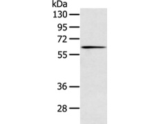 兔抗IL18RAP多克隆抗体