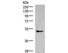 兔抗KCNJ2多克隆抗体