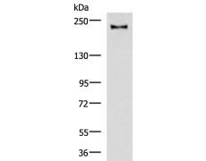 兔抗KIF21B多克隆抗体