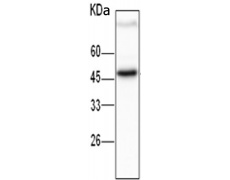 小鼠抗SKP2单克隆抗体