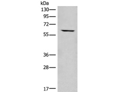 兔抗CCT6B多克隆抗体
