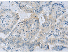 兔抗CDH12多克隆抗体