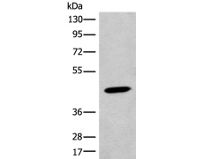 兔抗ACKR2多克隆抗体 