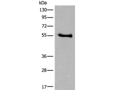 兔抗CCDC85C多克隆抗体