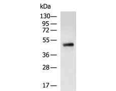 兔抗CD274多克隆抗体