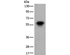兔抗CDT1多克隆抗体